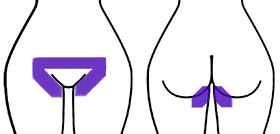 Diagram showing hair removal only along the bikini line (sides and top), leaving the rest natural