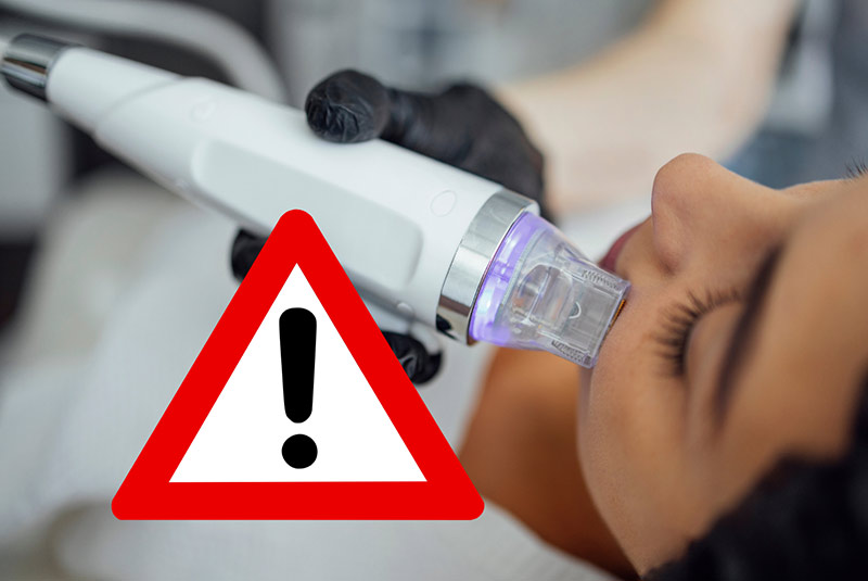 RF Microneedling FDA Safety Warning
