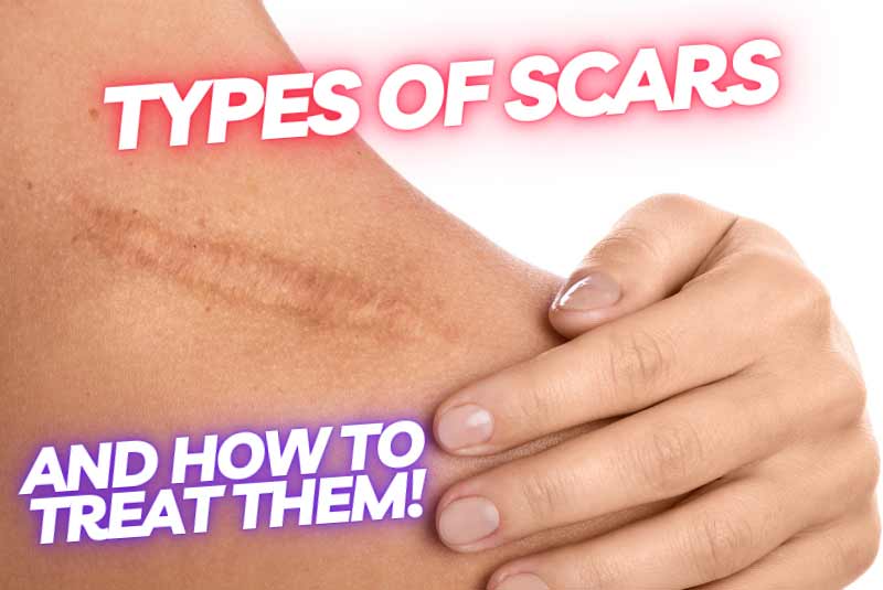 Waxing Aftercare guide: The Real Science blog image for Hideaway Spa