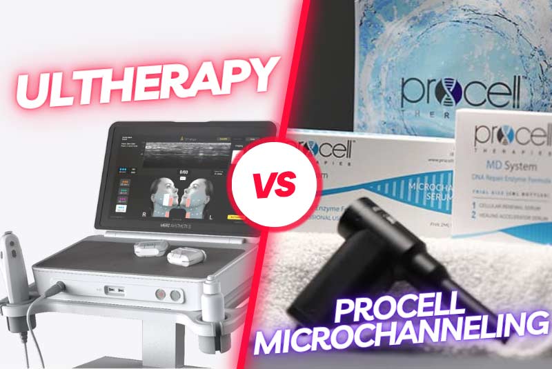Ultherapy Vs Microchanneling