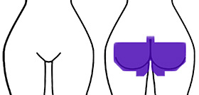 Diagram of what's removed during a buttocks wax at Hideaway Spa in Windsor