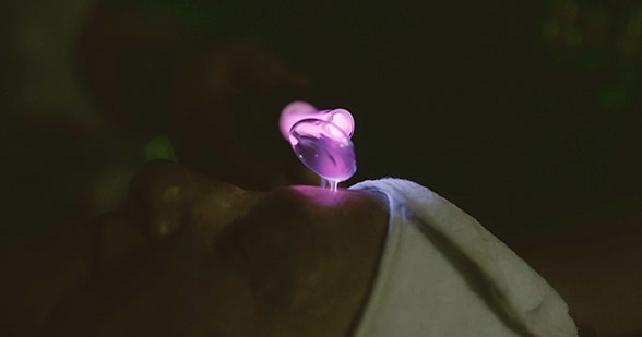 High frequency in use during a facial at Hideaway Spa in Windsor