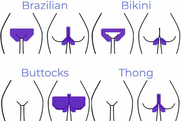 Areas of hair removal during brazilain, bikini, thong and buttocks waxes at Hideaway Spa