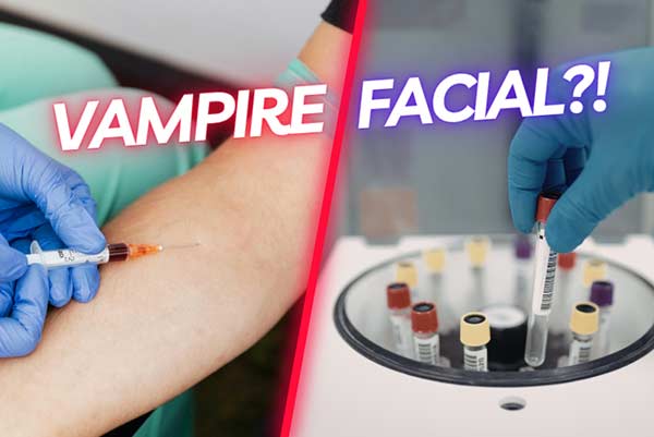 Vampire Facial PRP process - blood draw and centrifuge for microneedling serum